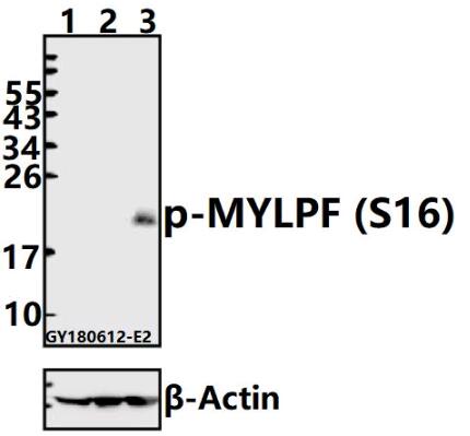 Western blot (WB) analysis of p-MYLPF (S16) pAb at 1:500 dilution
Lane1:HEK293T whole cell lysate(40ug)
Lane2:K562 whole cell lysate(40ug)
Lane3:The Muscle tissue lysate of Rat(40ug)