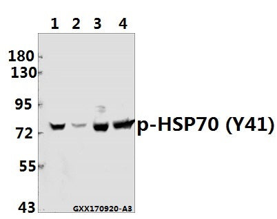 Western blot (WB) analysis of HSP70 (phospho-Y41) pAb at 1:500 dilution
Lane1:MCF-7 whole cell lysate(40ug)
Lane2:SK-OVCAR3 whole cell lysate(40ug)
Lane3:The Testis tissue lysate of Mouse(40ug)
Lane4:The Testis tissue lysate of Rat(40ug)
