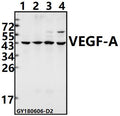 Western blot (WB) analysis of VEGF-A (L98) pAb at 1:500 dilution
Lane1:LOVO whole cell lysate(40ug)
Lane2:Panc1 whole cell lysate(40ug)
Lane3:CT26 whole cell lysate(40ug)
Lane4:H9C2 whole cell lysate(40ug)
