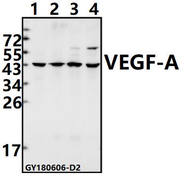 Western blot (WB) analysis of VEGF-A (L98) pAb at 1:500 dilution
Lane1:LOVO whole cell lysate(40ug)
Lane2:Panc1 whole cell lysate(40ug)
Lane3:CT26 whole cell lysate(40ug)
Lane4:H9C2 whole cell lysate(40ug)