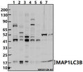 Western blot (WB) analysis of MAP1LC3B (D23) at 1:2000 dilution
Lane1:Hela whole cell lysate(30ug)
Lane2:U-87MG whole cell lysate(30ug)
Lane3:HepG2 whole cell lysate(30ug)
Lane4:3T3-L1 whole cell lysate(30ug)
Lane5:PC12 whole cell lysate(30ug)
Lane6:The Brain tissue lysate of Mouse(30ug)
Lane7:The Brain tissue lysate of Rat(30ug)