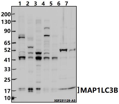 Western blot (WB) analysis of MAP1LC3B (D23) at 1:2000 dilution
Lane1:Hela whole cell lysate(30ug)
Lane2:U-87MG whole cell lysate(30ug)
Lane3:HepG2 whole cell lysate(30ug)
Lane4:3T3-L1 whole cell lysate(30ug)
Lane5:PC12 whole cell lysate(30ug)
Lane6:The Brain tissue lysate of Mouse(30ug)
Lane7:The Brain tissue lysate of Rat(30ug)