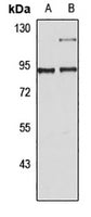 Western blot analysis of extracts of various cell lines, using PGC1α antibody  at 1:1000 dilution.
Secondary antibody: HRP Goat Anti-Rabbit IgG   at 1:10000 dilution.
Lysates/proteins: 25ug per lane.
Blocking buffer: 3% nonfat dry milk in TBST.
Detection: ECL Basic Kit .
Exposure time: 5s.