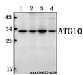 Western blot (WB) analysis of ATG10 (P220) polyclonal antibody at 1:500 dilution
Lane1:Hct116 whole cell lysate(40ug)
Lane2:786-O whole cell lysate(40ug)
Lane3:SGC-7901 whole cell lysate(40ug)
Lane4:HEK293T whole cell lysate(40ug)