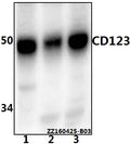 Western blot (WB) analysis of CD123 (Q192) polyclonal antibody at 1:1000 dilution
Lane1:MCF-7 whole cell lysate(20ug)
Lane2:THP-1 whole cell lysate(20ug)
Lane3:Jurkat whole cell lysate(20ug)