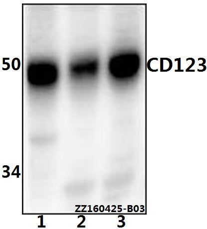 Western blot (WB) analysis of CD123 (Q192) polyclonal antibody at 1:1000 dilution
Lane1:MCF-7 whole cell lysate(20ug)
Lane2:THP-1 whole cell lysate(20ug)
Lane3:Jurkat whole cell lysate(20ug)