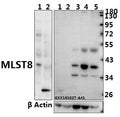 Western blot (WB) analysis of MLST8 polyclonal antibody at 1:500 dilution
Lane1:The Heart tissue lysate of Mouse(40ug)
Lane2:The Heart tissue lysate of Rat(40ug)
Lane3:HCC827 whole cell lysate(40ug)
Lane4:L02 whole cell lysate(40ug)
Lane5:HEK293T whole cell lysate(40ug)