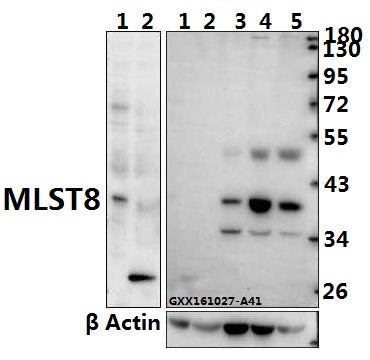 Western blot (WB) analysis of MLST8 polyclonal antibody at 1:500 dilution
Lane1:The Heart tissue lysate of Mouse(40ug)
Lane2:The Heart tissue lysate of Rat(40ug)
Lane3:HCC827 whole cell lysate(40ug)
Lane4:L02 whole cell lysate(40ug)
Lane5:HEK293T whole cell lysate(40ug)