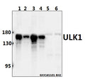 Western blot (WB) analysis of ULK1 polyclonal antibody at 1:1000 dilution
Lane1:L02 whole cell lysate(20ug)
Lane2:Panc1 whole cell lysate(20ug)
Lane3:HEK293T whole cell lysate(40ug)
Lane4:HCC827 whole cell lysate(40ug)
Lane5:The Brain tissue lysate of Rat(40ug)
Lane6:The Brain tissue lysate of Mouse(40ug)
