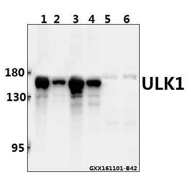 Western blot (WB) analysis of ULK1 polyclonal antibody at 1:1000 dilution
Lane1:L02 whole cell lysate(20ug)
Lane2:Panc1 whole cell lysate(20ug)
Lane3:HEK293T whole cell lysate(40ug)
Lane4:HCC827 whole cell lysate(40ug)
Lane5:The Brain tissue lysate of Rat(40ug)
Lane6:The Brain tissue lysate of Mouse(40ug)