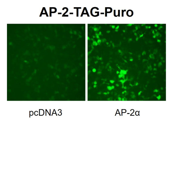 AP2 Reporter Lentivirus – Figure 1