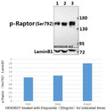 Western blot analysis of extracts of 293T cells, using Phospho-Raptor-Ser792 antibody at 1:1000 dilution.293T cells were treated by Oligomycin (0.5 uM) at 37℃ for 30 minutes after serum-starvation overnight.
Lysates/proteins: 25ug per lane.