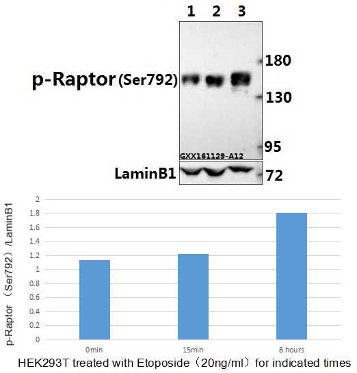 Western blot analysis of extracts of 293T cells, using Phospho-Raptor-Ser792 antibody at 1:1000 dilution.293T cells were treated by Oligomycin (0.5 uM) at 37℃ for 30 minutes after serum-starvation overnight.
Lysates/proteins: 25ug per lane.