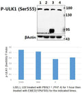 Western blot (WB) analysis of PIK3C3/VPS34 (Phospho-Ser249) polyclonal antibody at 1:500 dilution
Lane1:LO2 treated with PBS(1×,PH7.4) for 1 hour then treated with DMEM(10%FBS) for 15 minutes whole cell lysate
Lane2:LO2 treated with PBS(1×,PH7.4) for 1 hour then treated with DMEM(10%FBS) for 5 minutes whole cell lysate
Lane3:LO2 treated with PBS(1×,PH7.4) for 1 hour whole cell lysate
Lane4:LO2 whole cell lysate