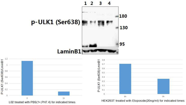 Western blot (WB) analysis of ULK1 (Phospho-Ser638) polyclonal antibody at 1:500 dilution
Lane1:L02 whole cell lysate
Lane2:L02 treated with PBS(1×PBS,PH7.4) for 1 hour whole cell lysate
Lane3:HEK293T treated with Etoposide(20ng/ml) for 6 hours whole cell lysate
Lane4:HEK293T whole cell lysate
