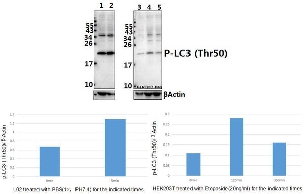 Western blot (WB) analysis of LC3 (phospho-Thr50) polyclonal antibody at 1:500 dilution
Lane1:L02 whole cell lysate(40ug)
Lane2:L02 treated with PBS(1×PBS,PH7.4) for 1 hour whole cell lysate(40ug)
Lane3:HEK293T whole cell lysate(40ug)
Lane4:HEK293T treated with Etoposide(20ng/ml) for 30 minutes whole cell lysate(40ug)
Lane5:HEK293T treated with Etoposide(20ng/ml) for 6 hours whole cell lysate(40ug)