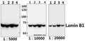 Western blot (WB) analysis of Lamin B1 polyclonal antibody at 1:20000 dilution
Lane1:A549 whole cell lysate(40ug)
Lane2:DLD whole cell lysate(40ug)
Lane3:The Spleen tissue lysate of Mouse(40ug)
Lane4:The Lung tissue lysate of Rat(40ug)