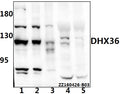 Western blot (WB) analysis of DHX36 polyclonal antibody at 1:500 dilution
Lane1:PC3 whole cell lysate(40ug)
Lane2:L02 whole cell lysate(20ug)
Lane3:HEK293T whole cell lysate(20ug)
Lane4:The liver tissue lysate of Mouse(40ug)
Lane5:The liver tissue lysate of Rat(40ug)