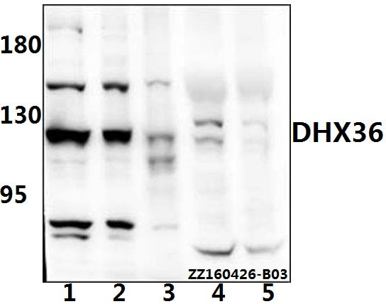 Western blot (WB) analysis of DHX36 polyclonal antibody at 1:500 dilution
Lane1:PC3 whole cell lysate(40ug)
Lane2:L02 whole cell lysate(20ug)
Lane3:HEK293T whole cell lysate(20ug)
Lane4:The liver tissue lysate of Mouse(40ug)
Lane5:The liver tissue lysate of Rat(40ug)