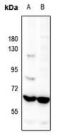 Western blot analysis of Occludin expression in mouse kidney (A), rat kidney (B) whole cell lysates.