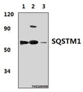 Western blot (WB) analysis of SQSTM1 polyclonal antibody at 1:500 dillution
Lane1:Hela whole cell lysate(40μg)
Lane2:NIH-3T3 whole cell lysate(30μg)
Lane3:PC12 whole cell lysate(40μg)