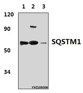 Western blot (WB) analysis of SQSTM1 polyclonal antibody at 1:500 dillution
Lane1:Hela whole cell lysate(40μg)
Lane2:NIH-3T3 whole cell lysate(30μg)
Lane3:PC12 whole cell lysate(40μg)