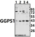 Western blot (WB) analysis of GGPS1 pAb at 1:500 dilution
Lane1:C6 whole cell lysate(40ug)
Lane2:3T3-L1 whole cell lysate(40ug)
Lane3:A375 whole cell lysate(40ug)
Lane4:K562 whole cell lysate(40ug)