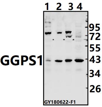 Western blot (WB) analysis of GGPS1 pAb at 1:500 dilution
Lane1:C6 whole cell lysate(40ug)
Lane2:3T3-L1 whole cell lysate(40ug)
Lane3:A375 whole cell lysate(40ug)
Lane4:K562 whole cell lysate(40ug)