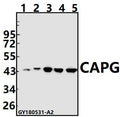 Western blot (WB) analysis of CAPG pAb at 1:500 dilution
Lane1:The Lung tissue lysate of Mouse(40ug)
Lane2:The Lung tissue lysate of Rat(40ug)
Lane3:A549 whole cell lysate(40ug)
Lane4:H1792 whole cell lysate(40ug)
Lane5:A375 whole cell lysate(40ug)