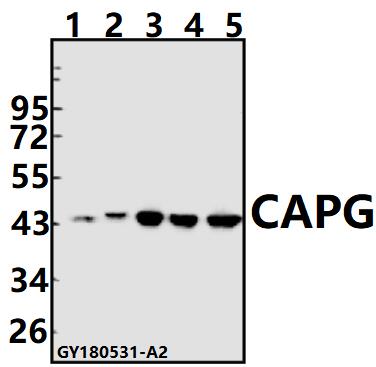 Western blot (WB) analysis of CAPG pAb at 1:500 dilution
Lane1:The Lung tissue lysate of Mouse(40ug)
Lane2:The Lung tissue lysate of Rat(40ug)
Lane3:A549 whole cell lysate(40ug)
Lane4:H1792 whole cell lysate(40ug)
Lane5:A375 whole cell lysate(40ug)