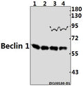 Western blot (WB) analysis of Beclin 1 pAb at 1:2000 dilution
Lane1:AML-12 whole cell lysate(40ug)
Lane2:PMVEC whole cell lysate(40ug)
Lane3:HEK293T whole cell lysate(40ug)
Lane4:A549 whole cell lysate(40ug)