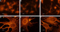 Anti-CNGA2 Antibody