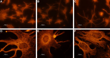Anti-CNGA2 Antibody