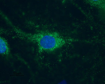 Anti-HCN1 Antibody