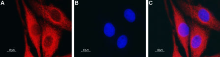 Anti-Aquaporin 4 (AQP4) (300-314) Antibody