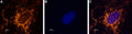 Anti-SCN1A (NaV1.1) Antibody