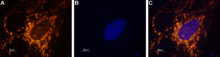 Anti-SCN1A (NaV1.1) Antibody