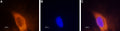 Anti-SCN3A (NaV1.3) Antibody
