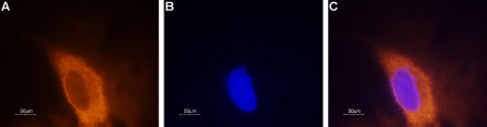 Anti-SCN3A (NaV1.3) Antibody