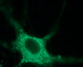 Anti-NaV1.7 (SCN9A) Antibody
