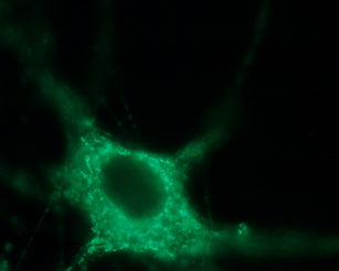Anti-NaV1.7 (SCN9A) Antibody