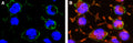 Anti-Human NaV1.7 (SCN9A) (extracellular) Antibody