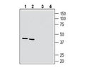5HT7 Receptor/HTR7 (extracellular) Blocking Peptide