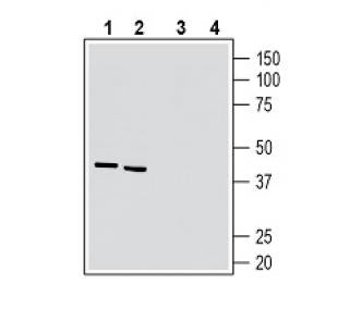 5HT7 Receptor/HTR7 (extracellular) Blocking Peptide