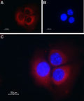 Anti-TRIC-B (TMEM38B) Antibody