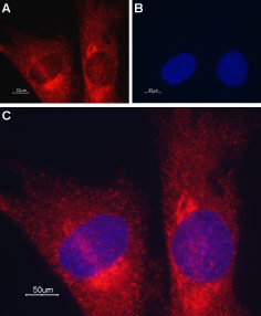 Anti-TRIC-A (TMEM38A) Antibody