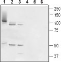 Anti-TMC6 (EVER1) Antibody