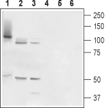 Anti-TMC6 (EVER1) Antibody