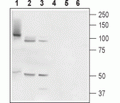 TMC6/EVER1 Blocking Peptide