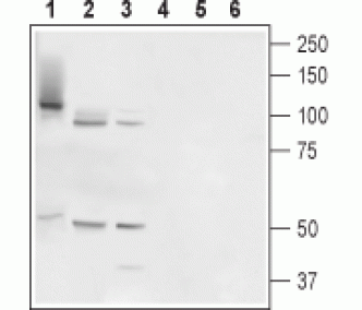 TMC6/EVER1 Blocking Peptide